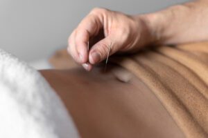 Acupuncture for Digestive Conditions